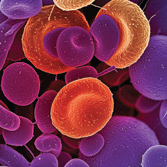 Drugs to deliver a deadly one-two punch to leukemia.