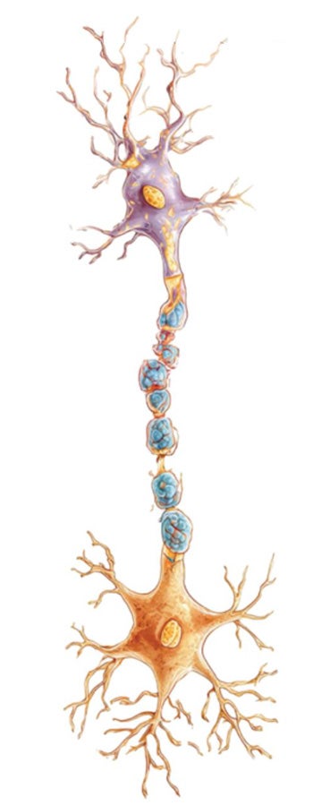 amyloid