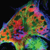 Artificial gene expression of the human oncogene MYCN 